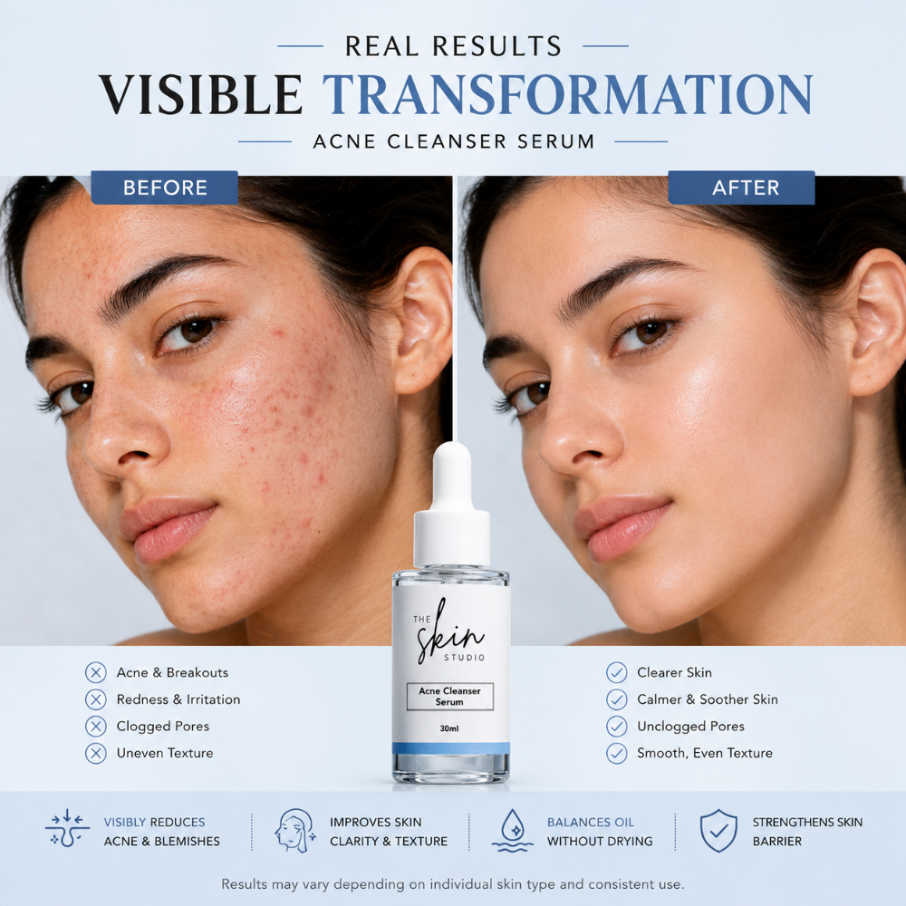Acne Cleanser Serum